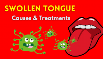Swollen Tongue Causes & Treatments